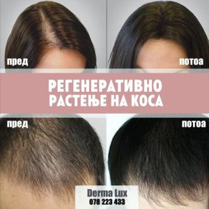 regeneriranje na kosa